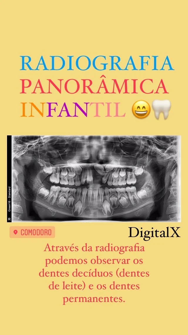 Material da DigitalX sobre radiografia panorâmica infantil