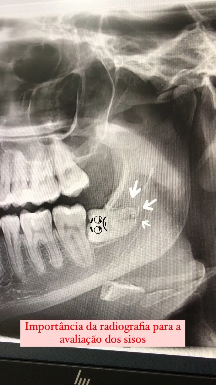 Registro radiográfico odontológico fornecido pela clínica