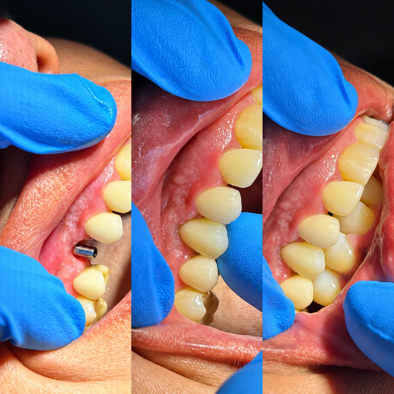Montagem com três registros odontológicos de um sorriso
