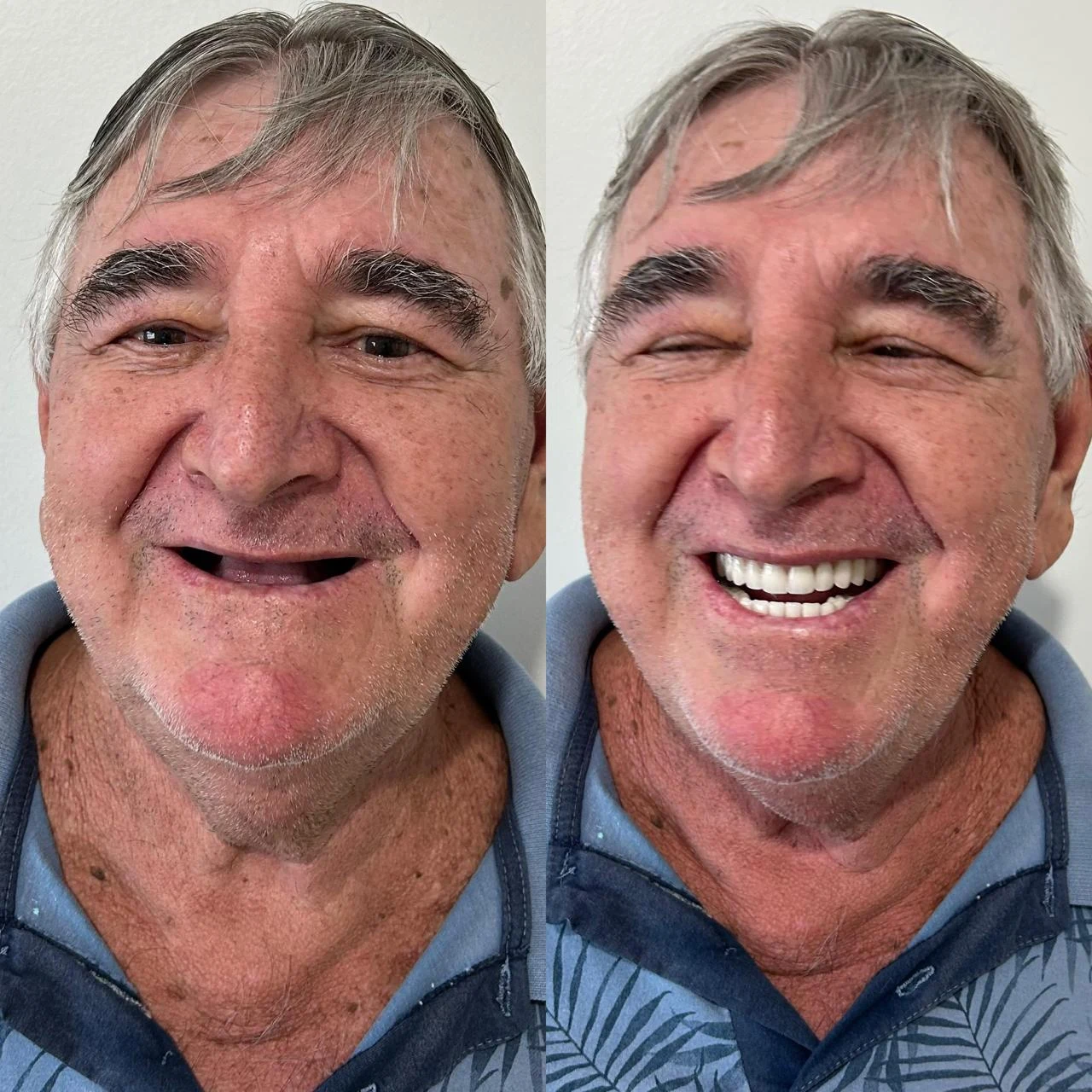 Montagem com dois retratos de um paciente