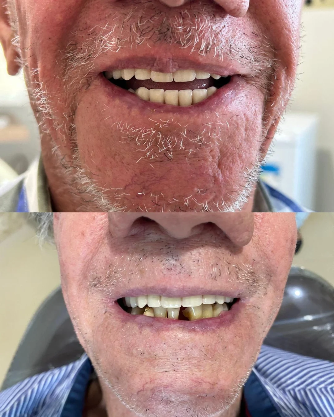 Montagem com dois registros aproximados de um sorriso
